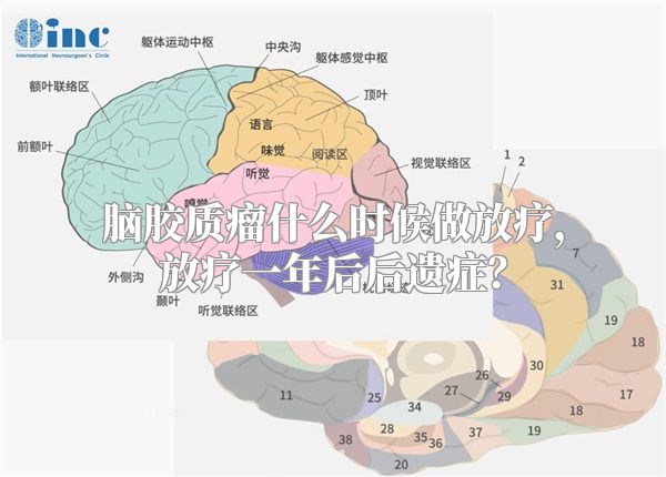 脑胶质瘤什么时候做放疗，放疗一年后后遗症？