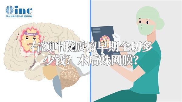 右额叶胶质瘤早期全切多少钱？术后蛛网膜？