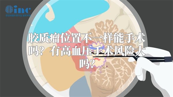 胶质瘤位置不一样能手术吗？有高血压手术风险大吗？