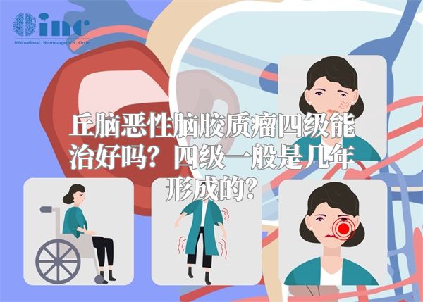 丘脑恶性脑胶质瘤四级能治好吗？四级一般是几年形成的？