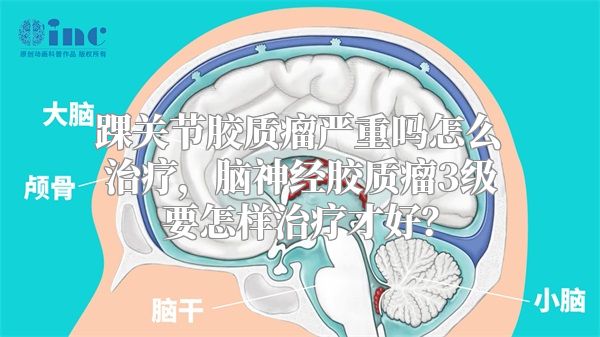 踝关节胶质瘤严重吗怎么治疗，脑神经胶质瘤3级要怎样治疗才好？