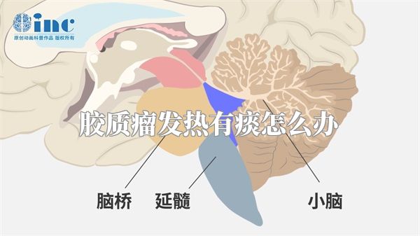 胶质瘤发热有痰怎么办