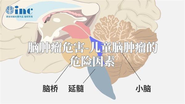 脑肿瘤危害-儿童脑肿瘤的危险因素