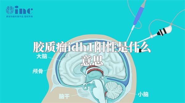 胶质瘤idh1阳性是什么意思