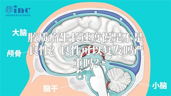 胶质瘤生长速度慢是不是良性？良性可以复发吗严重吗？