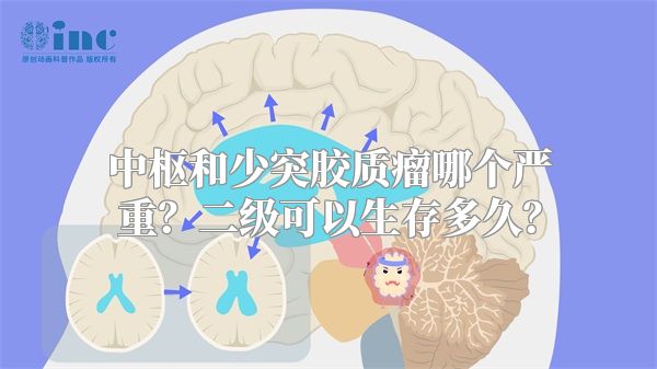 中枢和少突胶质瘤哪个严重？二级可以生存多久？