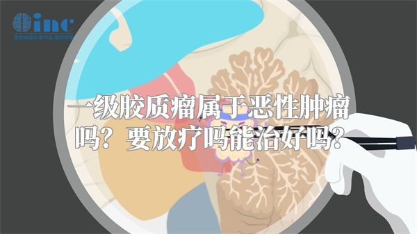 一级胶质瘤属于恶性肿瘤吗？要放疗吗能治好吗？