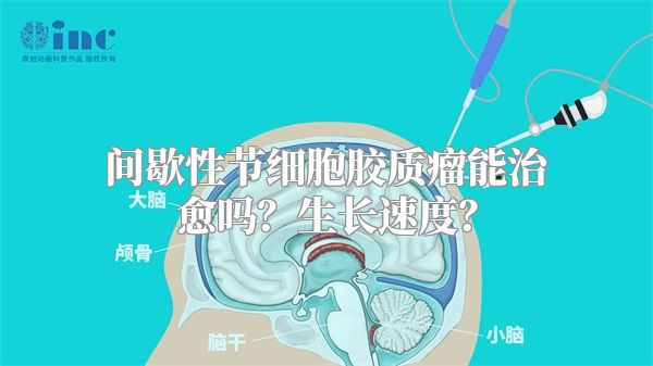 间歇性节细胞胶质瘤能治愈吗？生长速度？