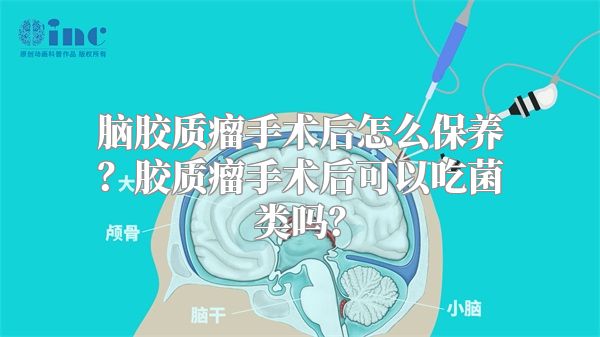 脑胶质瘤手术后怎么保养？胶质瘤手术后可以吃菌类吗？