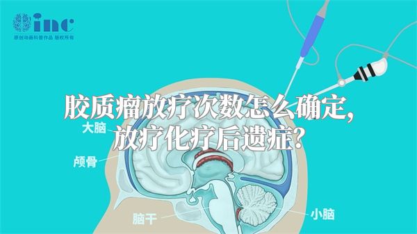 胶质瘤放疗次数怎么确定，放疗化疗后遗症？