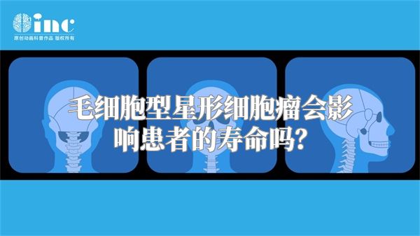 毛细胞型星形细胞瘤会影响患者的寿命吗？