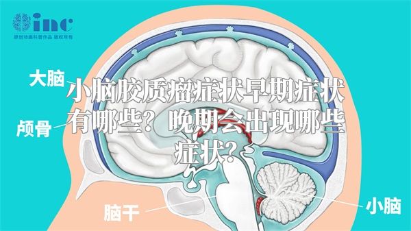 小脑胶质瘤症状早期症状有哪些？晚期会出现哪些症状？