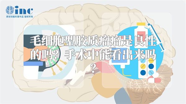 毛细胞型胶质瘤瘤是良性的吗？手术中能看出来吗？