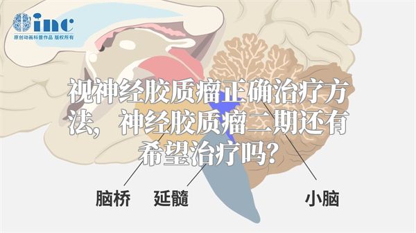 视神经胶质瘤正确治疗方法，神经胶质瘤二期还有希望治疗吗？