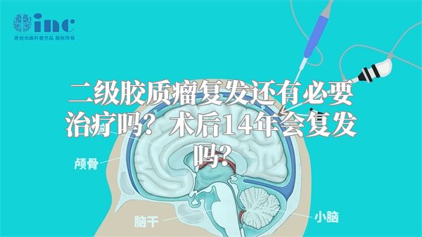 二级胶质瘤复发还有必要治疗吗？术后14年会复发吗？