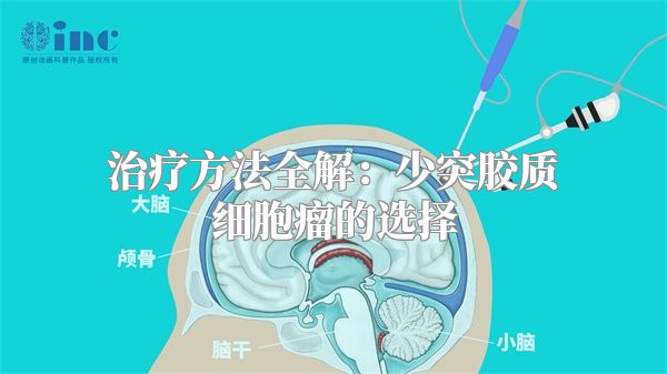 治疗方法全解：少突胶质细胞瘤的选择