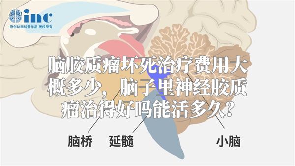 脑胶质瘤坏死治疗费用大概多少，脑子里神经胶质瘤治得好吗能活多久？