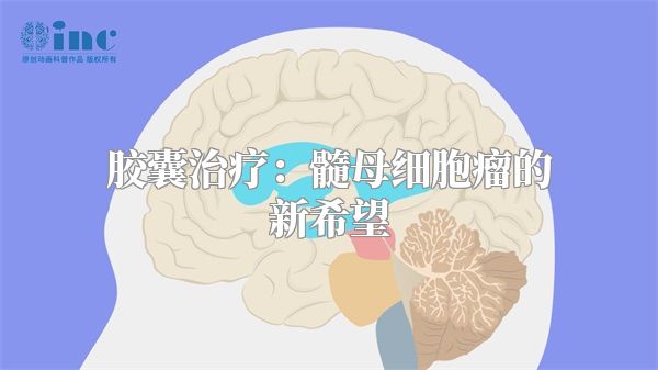 胶囊治疗：髓母细胞瘤的新希望