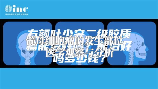 髓母细胞瘤的发生部位—医学观察与分析