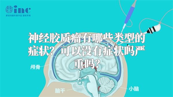 神经胶质瘤有哪些类型的症状？可以没有症状吗严重吗？