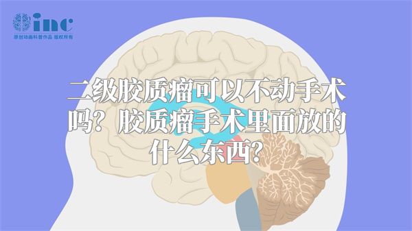 二级胶质瘤可以不动手术吗？胶质瘤手术里面放的什么东西？