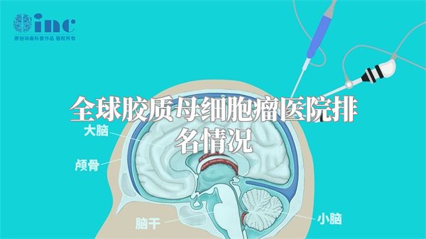 全球胶质母细胞瘤医院排名情况