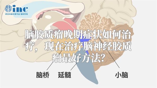 脑胶质瘤晚期症状如何治疗，现在治疗脑神经胶质瘤最好方法？