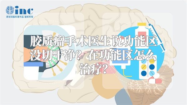 胶质瘤手术医生说功能区没切干净？在功能区怎么治疗？