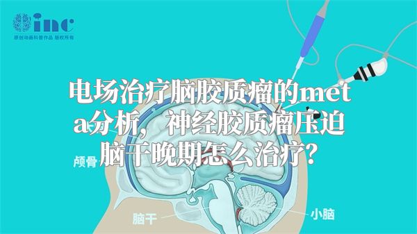 电场治疗脑胶质瘤的meta分析，神经胶质瘤压迫脑干晚期怎么治疗？