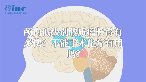 颅内低级别胶质瘤长得有多快？不能手术化疗有用吗？