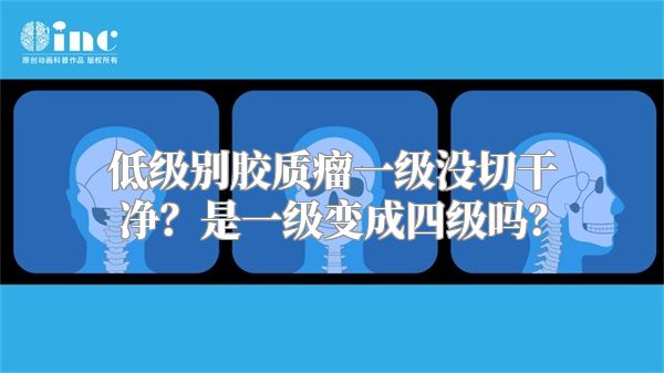 低级别胶质瘤一级没切干净？是一级变成四级吗？