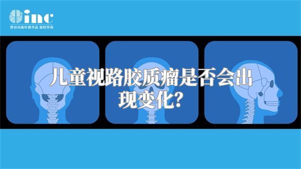 儿童视路胶质瘤是否会出现变化？