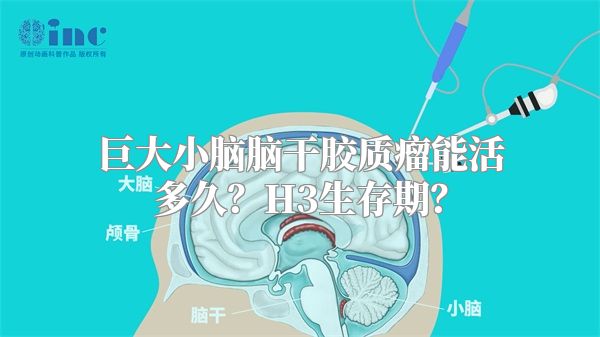 巨大小脑脑干胶质瘤能活多久？H3生存期？