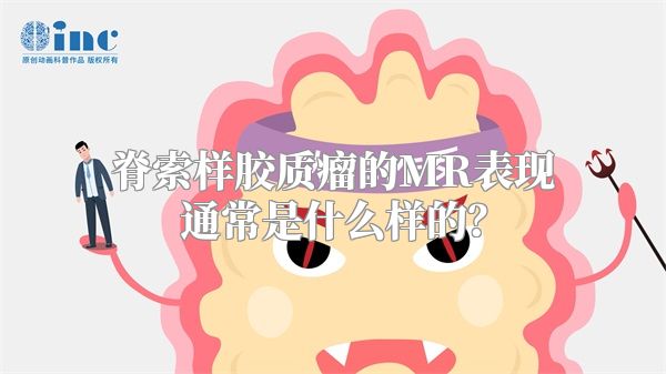 脊索样胶质瘤的MR表现通常是什么样的？