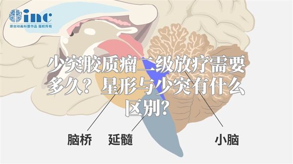 少突胶质瘤二级放疗需要多久？星形与少突有什么区别？