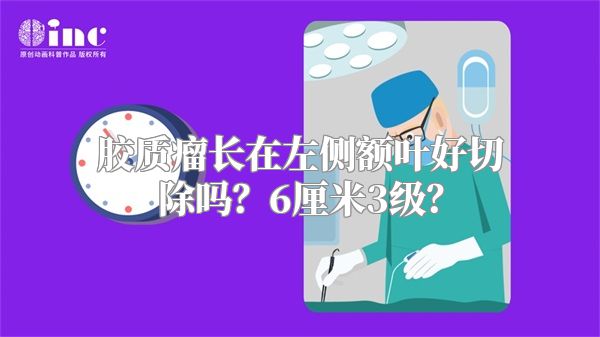 胶质瘤长在左侧额叶好切除吗？6厘米3级？