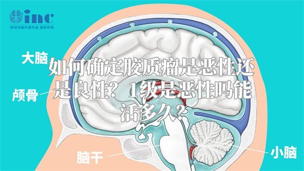 如何确定胶质瘤是恶性还是良性？1级是恶性吗能活多久？