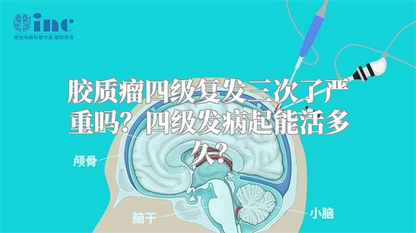 胶质瘤四级复发三次了严重吗？四级发病起能活多久？