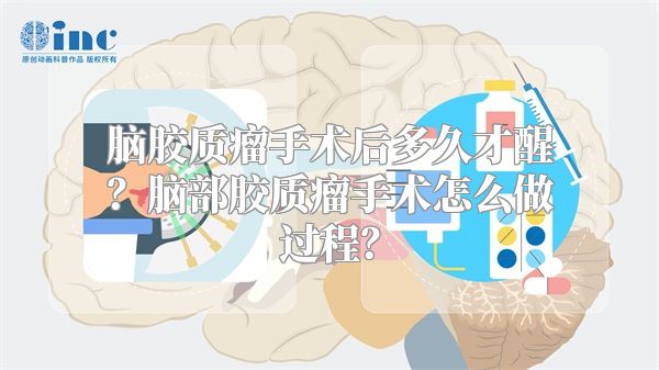 脑胶质瘤手术后多久才醒？脑部胶质瘤手术怎么做过程？