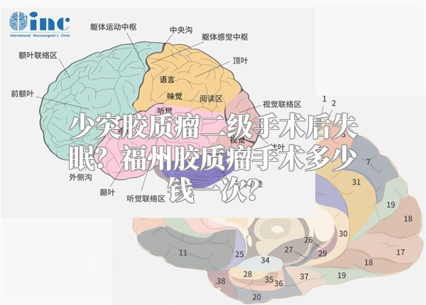 少突胶质瘤二级手术后失眠？福州胶质瘤手术多少钱一次？