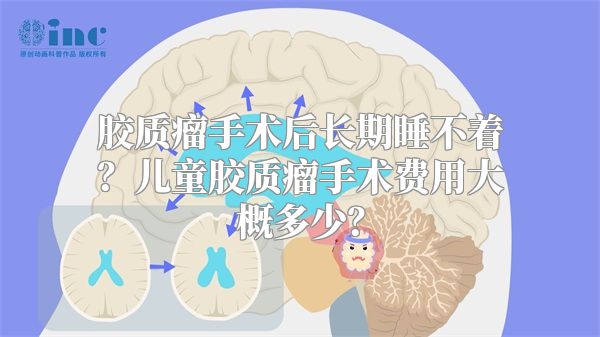 胶质瘤手术后长期睡不着？儿童胶质瘤手术费用大概多少？