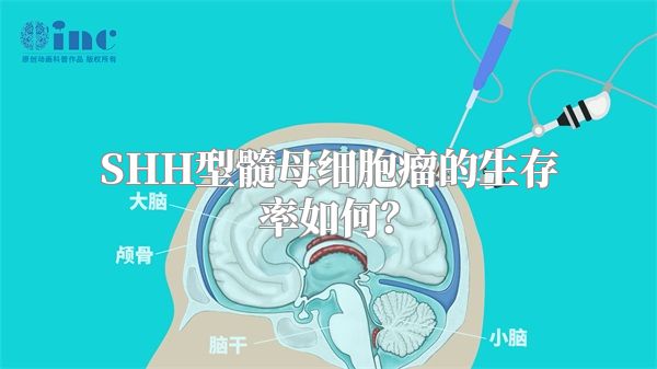 SHH型髓母细胞瘤的生存率如何？