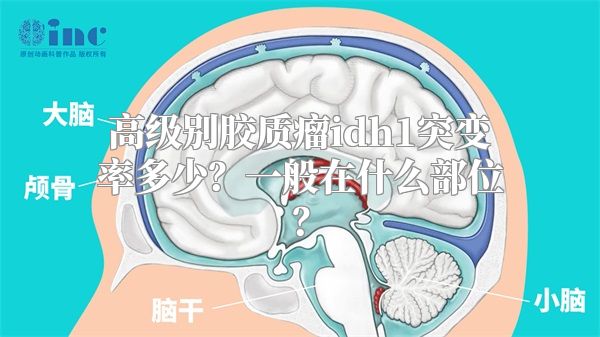 高级别胶质瘤idh1突变率多少？一般在什么部位？