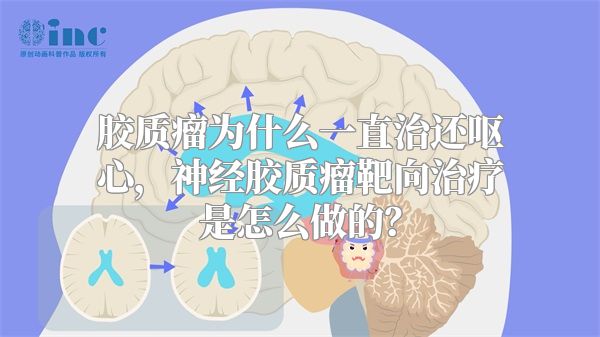 胶质瘤为什么一直治还呕心，神经胶质瘤靶向治疗是怎么做的？