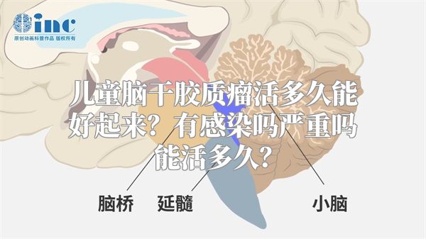 儿童脑干胶质瘤活多久能好起来？有感染吗严重吗能活多久？