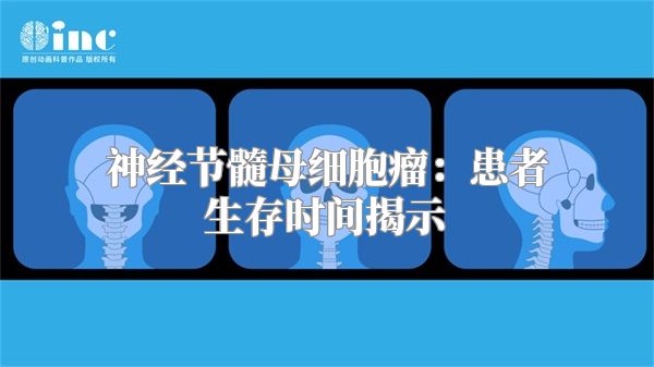 神经节髓母细胞瘤：患者生存时间揭示