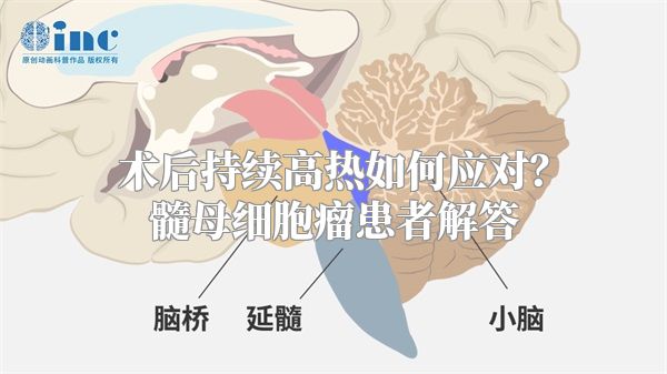 术后持续高热如何应对？髓母细胞瘤患者解答