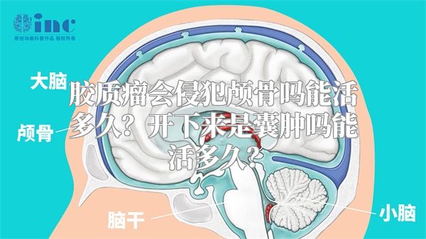 胶质瘤会侵犯颅骨吗能活多久？开下来是囊肿吗能活多久？