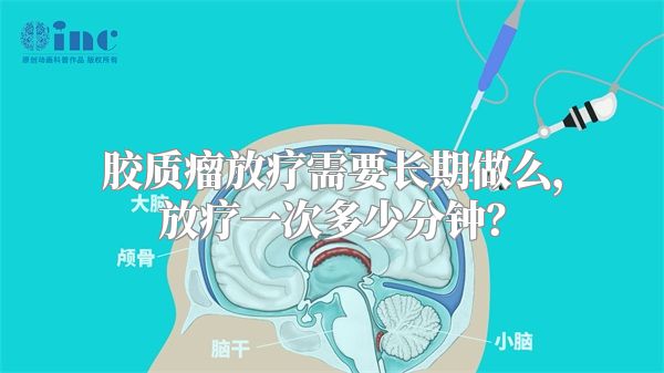 胶质瘤放疗需要长期做么，放疗一次多少分钟？