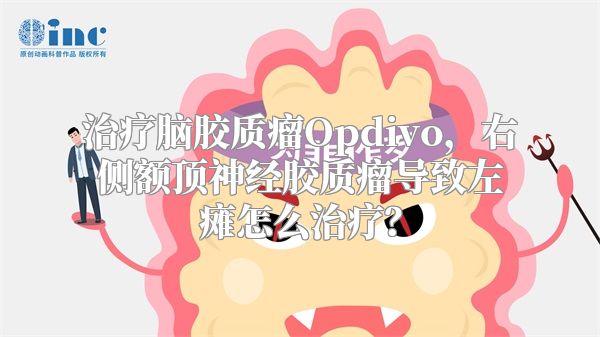 治疗脑胶质瘤Opdivo，右侧额顶神经胶质瘤导致左瘫怎么治疗？